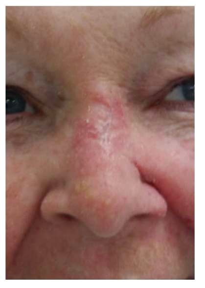 Close-up of a person's nose and eyes.